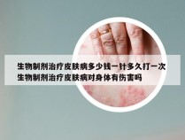 生物制剂治疗皮肤病多少钱一针多久打一次 生物制剂治疗皮肤病对身体有伤害吗