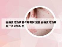 百癣夏塔热胶囊与片有何区别 百癣夏塔热片和什么药搭配吃