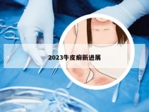 2023牛皮癣新进展