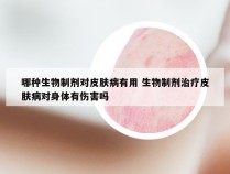 哪种生物制剂对皮肤病有用 生物制剂治疗皮肤病对身体有伤害吗