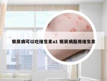 银屑病可以吃维生素a1 银屑病服用维生素