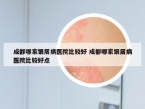 成都哪家银屑病医院比较好 成都哪家银屑病医院比较好点