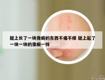 腿上长了一块像癣的东西不痛不痒 腿上起了一块一块的像癣一样