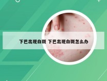 下巴出现白斑 下巴出现白斑怎么办