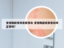 宝宝胸前有块皮肤发白 宝宝胸部皮肤有白块正常吗?