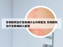 生物制剂治疗皮肤病什么时候普及 生物制剂治疗皮肤病纳入医保