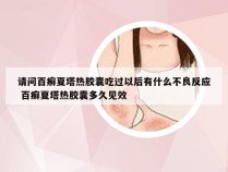 请问百癣夏塔热胶囊吃过以后有什么不良反应 百癣夏塔热胶囊多久见效