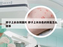 脖子上长白斑图片 脖子上长白色的斑是怎么回事