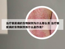 治疗银屑病的生物制剂为什么那么贵 治疗银屑病的生物制剂有什么副作用?