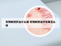 生物制剂药治什么病 生物制剂治疗效果怎么样