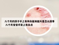 八个月的孩子手上有块白越来越大是怎么回事 八个月宝宝手背上有白点