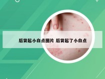 后背起小白点图片 后背起了小白点