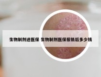 生物制剂进医保 生物制剂医保报销后多少钱