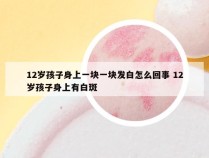 12岁孩子身上一块一块发白怎么回事 12岁孩子身上有白斑