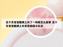 五个月宝宝胳膊上长了一块癣怎么回事 五个月宝宝胳膊上长密密麻麻小红点