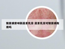 银屑病索咪新尿素乳膏 尿素乳膏对银屑病有用吗