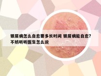 银屑病怎么自愈要多长时间 银屑病能自愈?不妨听听医生怎么说