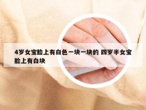 4岁女宝脸上有白色一块一块的 四岁半女宝脸上有白块