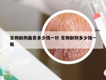 生物制剂最贵多少钱一针 生物制剂多少钱一瓶