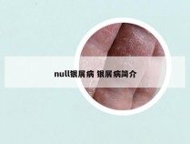 null银屑病 银屑病简介