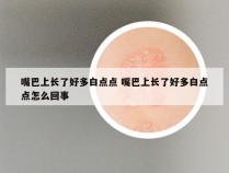 嘴巴上长了好多白点点 嘴巴上长了好多白点点怎么回事