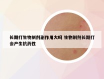 长期打生物制剂副作用大吗 生物制剂长期打会产生抗药性