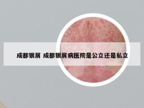 成都银屑 成都银屑病医院是公立还是私立