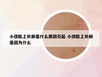 小孩脸上长癣是什么原因引起 小孩脸上长癣是因为什么