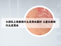 小孩头上有癣用什么洗发水最好 儿童头癣用什么洗发水