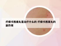 疗癣卡西甫丸是治疗什么的 疗癣卡西莆丸的副作用