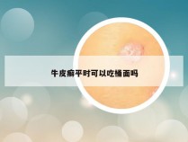 牛皮癣平时可以吃桶面吗