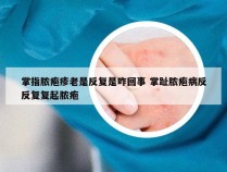 掌指脓疱疹老是反复是咋回事 掌趾脓疱病反反复复起脓疱