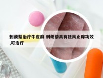 刺蒺藜治疗牛皮癣 刺蒺藜具有祛风止痒功效,可治疗