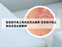 出生孩子身上有白点怎么回事 出生孩子身上有白点怎么回事啊