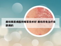 廊坊银屑病医院哪家技术好 廊坊市有治疗皮肤病的