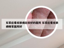 石家庄看皮肤病比较好的医院 石家庄看皮肤病哪家医院好