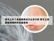 勃子上长了皮肤癣用点什么膏子好 脖子上皮肤癣用哪种药膏最有效