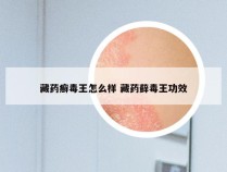 藏药癣毒王怎么样 藏药藓毒王功效