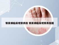 银屑病临床观察表格 银屑病临床观察表格图