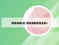 银屑病维e乳 银屑病服用维生素e