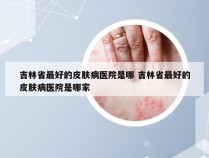 吉林省最好的皮肤病医院是哪 吉林省最好的皮肤病医院是哪家