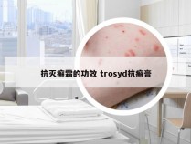 抗灭癣霜的功效 trosyd抗癣膏