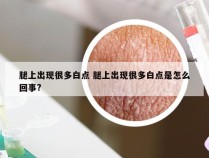 腿上出现很多白点 腿上出现很多白点是怎么回事?