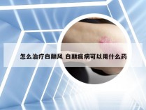 怎么治疗白颠风 白颠疯病可以用什么药