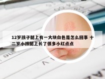 12岁孩子腿上有一大块白色是怎么回事 十二岁小孩腿上长了很多小红点点