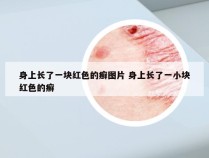 身上长了一块红色的癣图片 身上长了一小块红色的癣