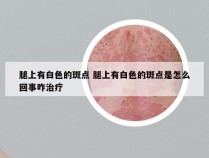 腿上有白色的斑点 腿上有白色的斑点是怎么回事咋治疗