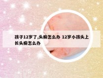 孩子12岁了,头癣怎么办 12岁小孩头上长头癣怎么办