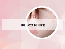 k癣王功效 癣王胶囊