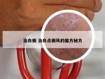 治白癜 治白点癫风的偏方秘方